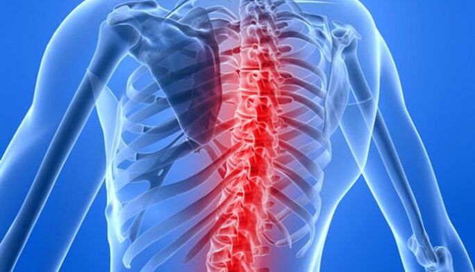 As patoloxías da columna vertebral son a causa máis común de dor nas costas na zona da escápula