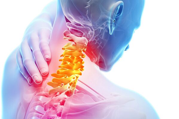 Osteocondrose cervical
