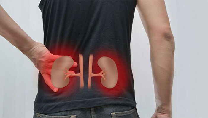 Dor lumbar debido a enfermidade renal