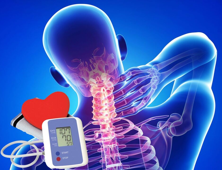 Saltos na presión arterial na osteocondrose cervical