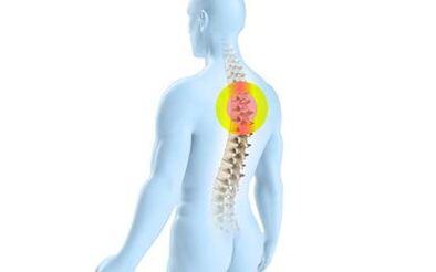 Osteocondrose da columna torácica