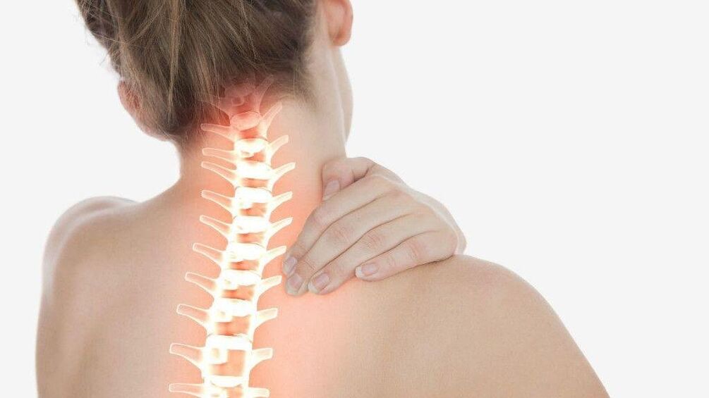 A síndrome radicular pode desenvolverse coa osteocondrose da columna cervical